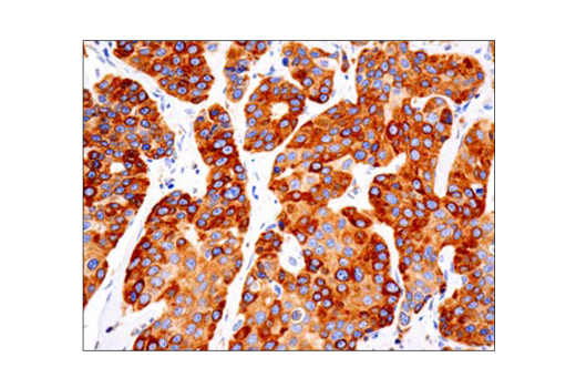 Immunohistochemistry Image 1: Bcl-2 (124) Mouse mAb