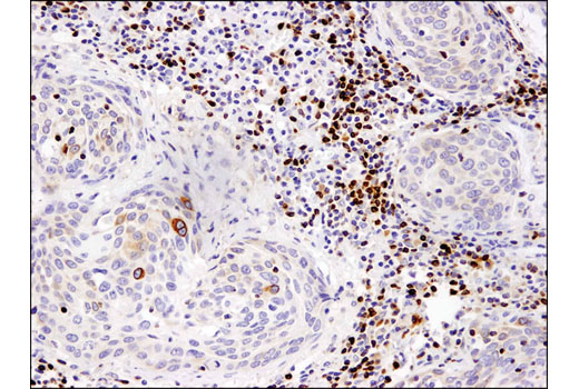 Immunohistochemistry Image 5: Bcl-2 (124) Mouse mAb