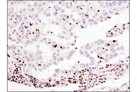Immunohistochemistry Image 1: Aiolos (D1C1E) Rabbit mAb (BSA and Azide Free)