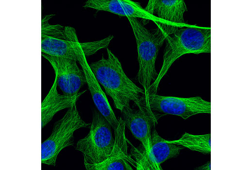 βtubulind2n5grabbitmab15115