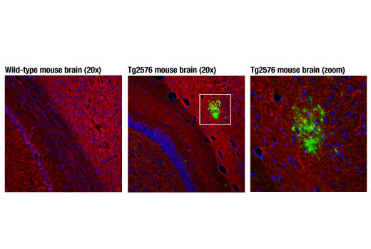  Image 18: β-Amyloid Mouse Model Neuronal Viability IF Antibody Sampler Kit