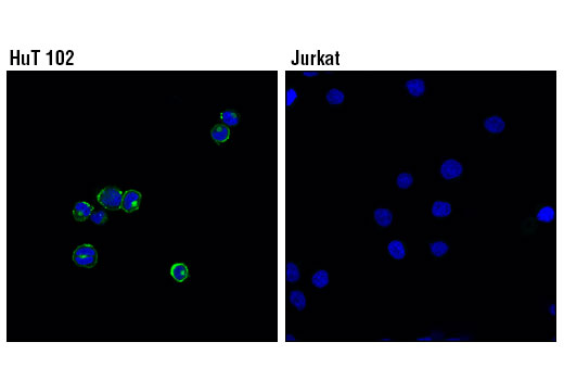 Immunofluorescence Image 1: OX40 (D1S6L) Rabbit mAb (Alexa Fluor® 488 Conjugate)