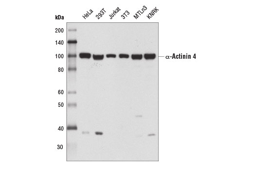 Western Blotting Image 1: α-Actinin 4 (D7U5A) Rabbit mAb 