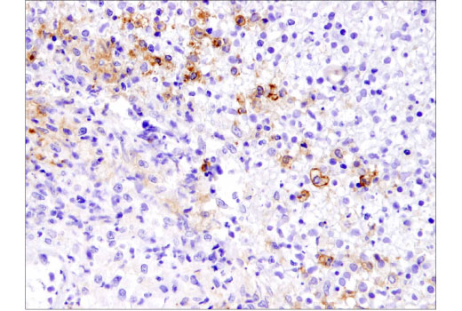 Immunohistochemistry Image 1: PD-L1 (Extracellular Domain Specific) (E1J2J™) Rabbit mAb