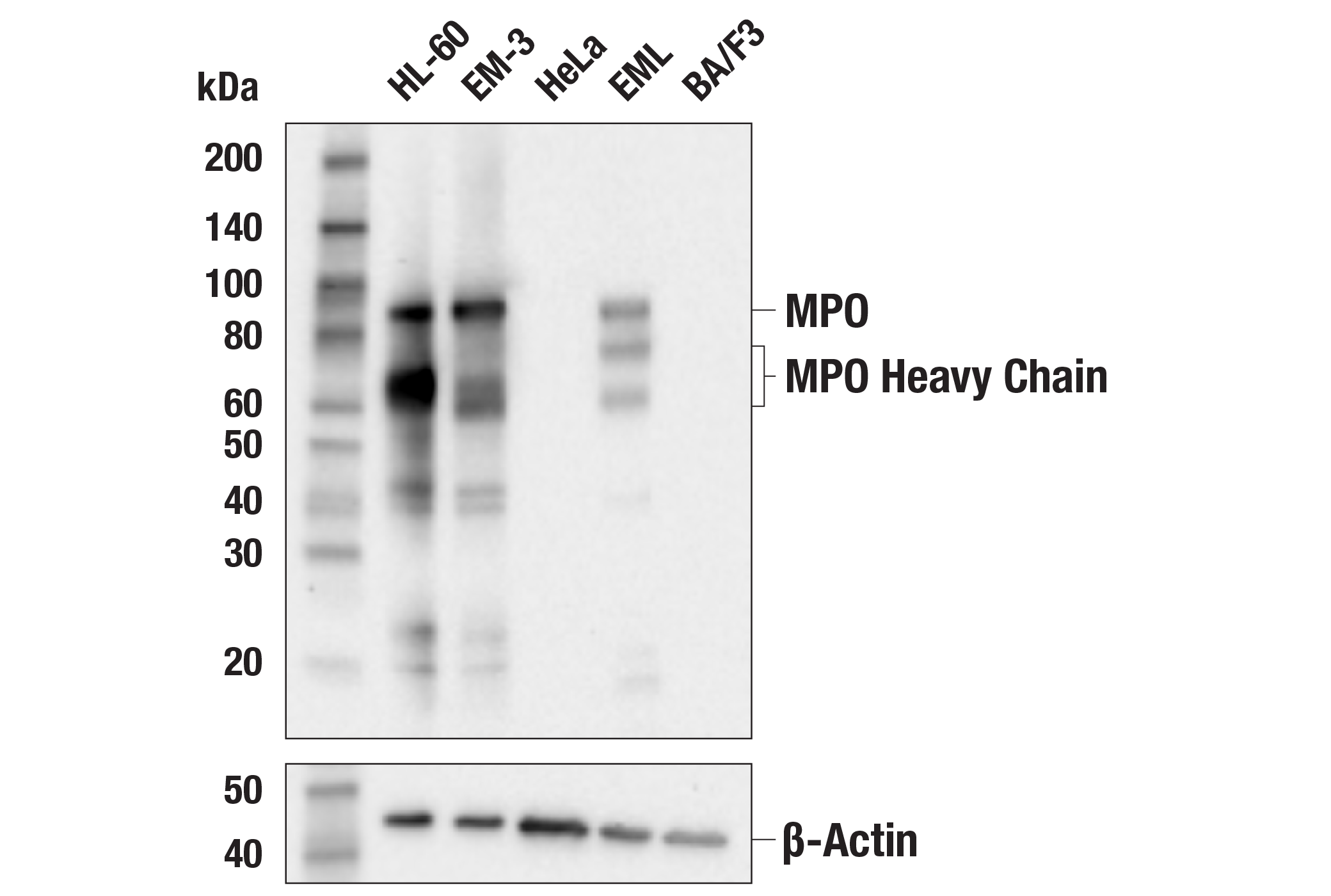 Western Blotting Image 1: Myeloperoxidase (E2Z8J) Rabbit mAb