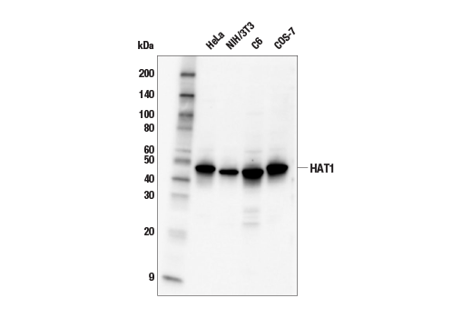 Western Blotting Image 1: HAT1 Antibody