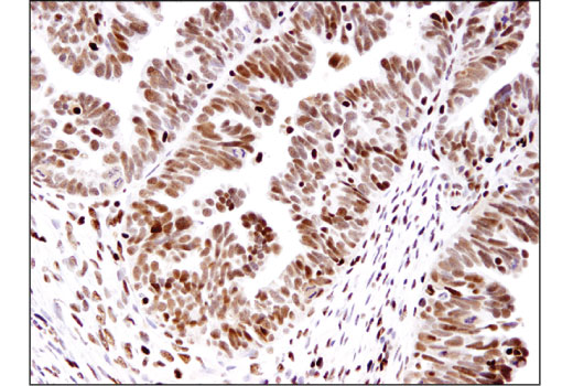 Immunohistochemistry Image 1: ANP32A (D7Z5U) Rabbit mAb
