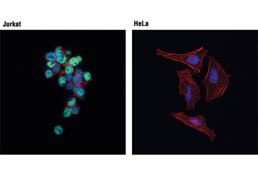 Immunofluorescence Image 3: Bcl-11B (D6F1) XP® Rabbit mAb (BSA and Azide Free)