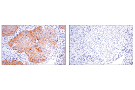 Immunohistochemistry Image 3: Phospho-SQSTM1/p62 (Ser349) (E7M1A) Rabbit mAb