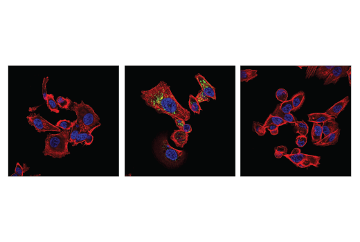 Immunofluorescence Image 1: Phospho-SQSTM1/p62 (Ser349) (E7M1A) Rabbit mAb