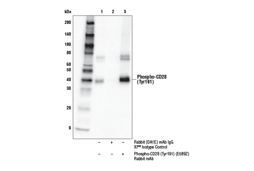 Immunoprecipitation Image 1: Phospho-CD28 (Tyr191) (E5B9Z) Rabbit mAb