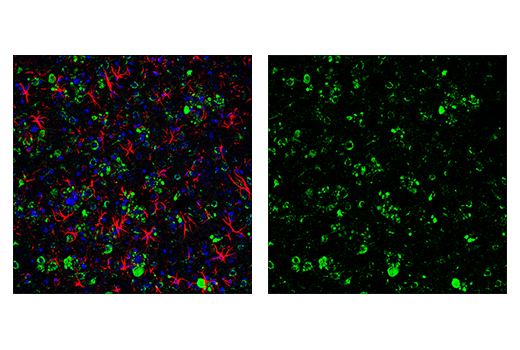 Immunofluorescence Image 2: APP (E9M5J) Rabbit mAb