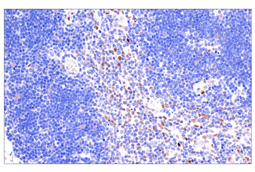 Immunohistochemistry Image 8: Bcl-3 (E4D4K) Rabbit mAb
