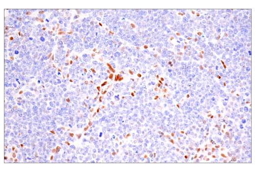 Immunohistochemistry Image 5: Bcl-3 (E4D4K) Rabbit mAb