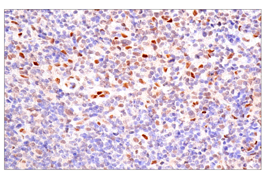 Immunohistochemistry Image 1: Bcl-3 (E4D4K) Rabbit mAb
