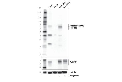 Western Blotting Image 1: Phospho-CaMKK2 (Ser495) Antibody