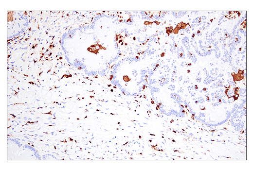  Image 55: Mouse Reactive Alzheimer's Disease Model Microglia Phenotyping IF Antibody Sampler Kit
