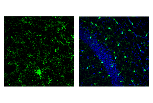  Image 62: Mouse Reactive Alzheimer's Disease Model Microglia Phenotyping IF Antibody Sampler Kit