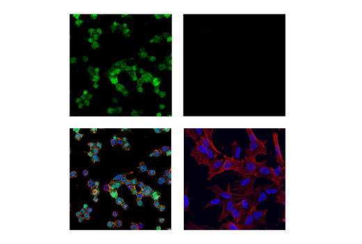  Image 73: Mouse Reactive Alzheimer's Disease Model Microglia Phenotyping IF Antibody Sampler Kit