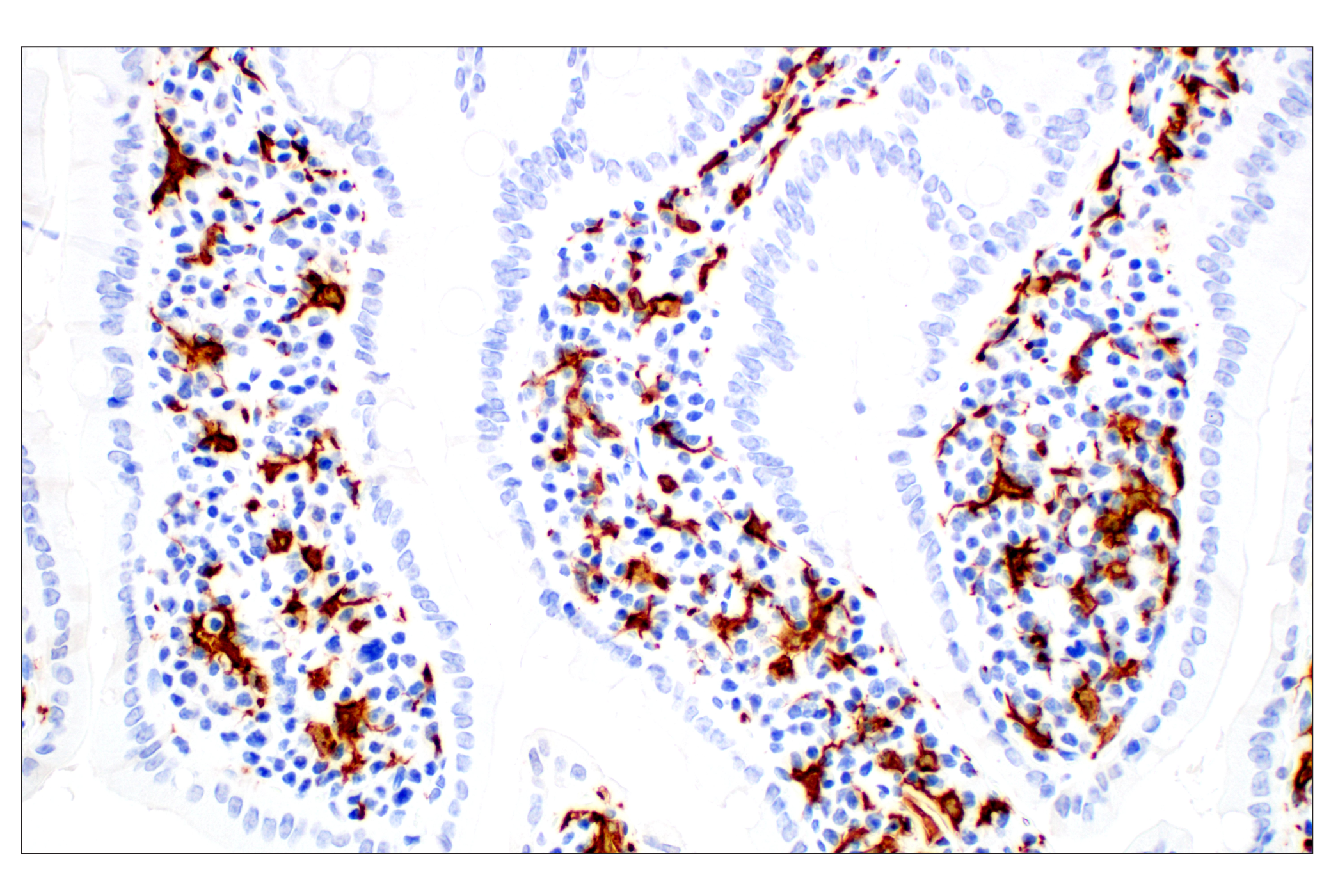  Image 60: Mouse Microglia Marker IF Antibody Sampler Kit
