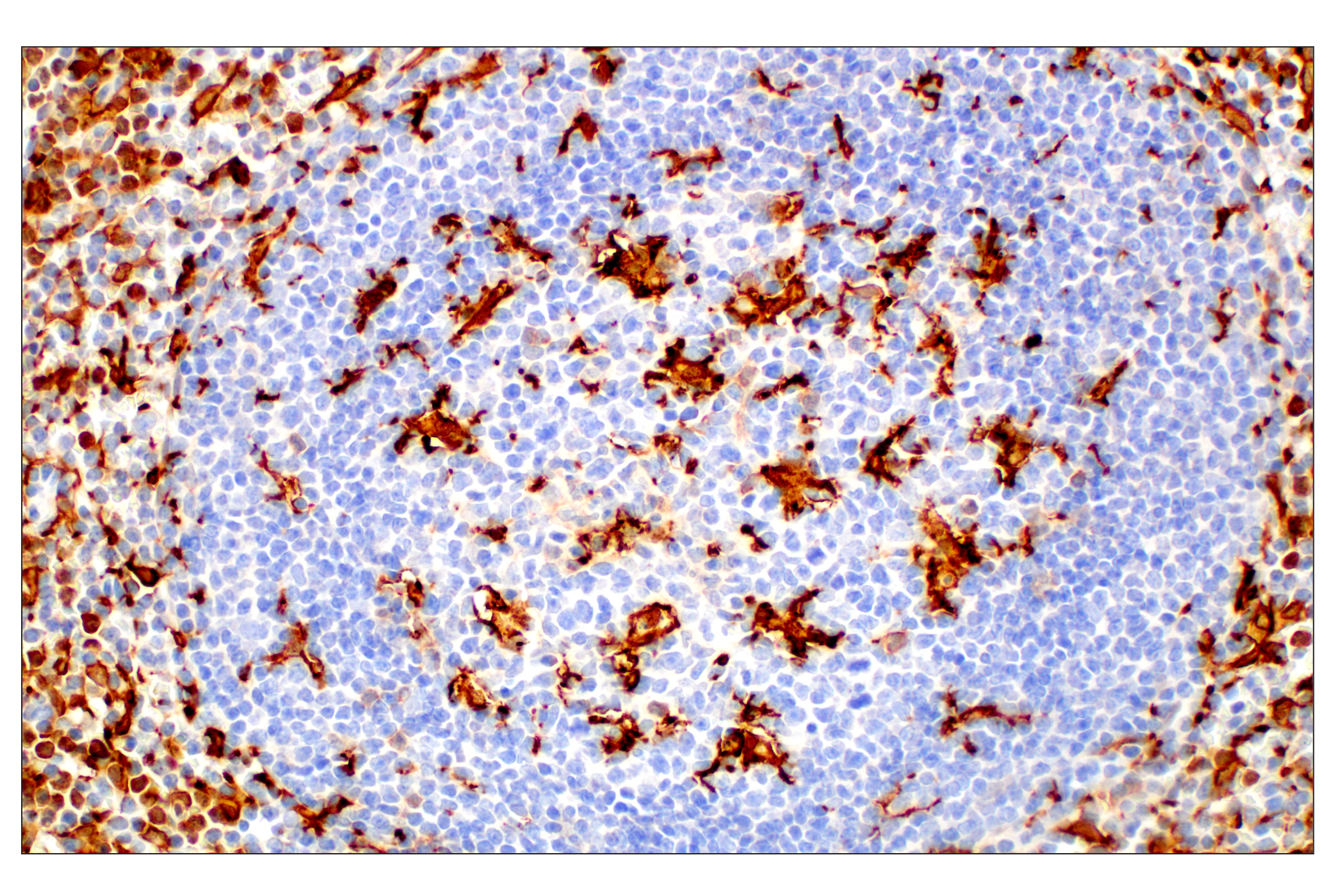  Image 68: Mouse Reactive M1 vs M2 Macrophage IHC Antibody Sampler Kit