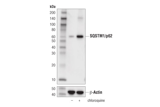 Western Blotting Image 4: SQSTM1/p62 (D5L7G) Mouse mAb (BSA and Azide Free)
