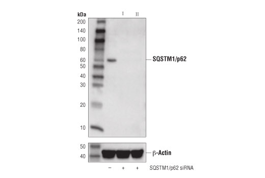 Western Blotting Image 5: SQSTM1/p62 (D5L7G) Mouse mAb (BSA and Azide Free)