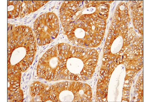 Immunohistochemistry Image 1: SQSTM1/p62 (D5L7G) Mouse mAb (BSA and Azide Free)