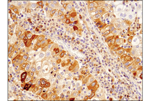 Immunohistochemistry Image 2: SQSTM1/p62 (D5L7G) Mouse mAb (BSA and Azide Free)