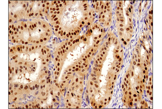 Immunohistochemistry Image 3: SQSTM1/p62 (D5L7G) Mouse mAb (BSA and Azide Free)