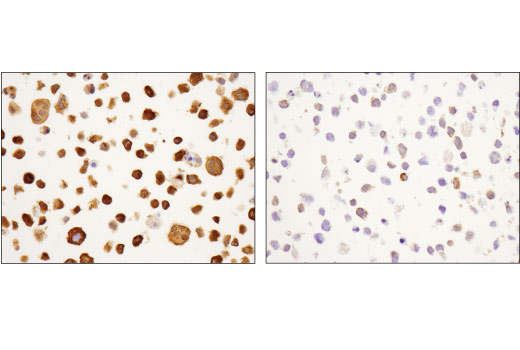 Immunohistochemistry Image 4: SQSTM1/p62 (D5L7G) Mouse mAb (BSA and Azide Free)