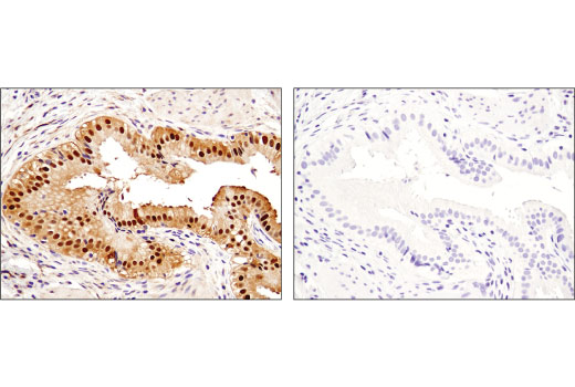 Immunohistochemistry Image 5: SQSTM1/p62 (D5L7G) Mouse mAb (BSA and Azide Free)