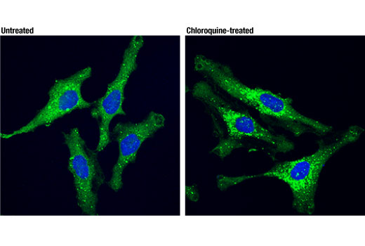 Immunofluorescence Image 1: SQSTM1/p62 (D5L7G) Mouse mAb (BSA and Azide Free)