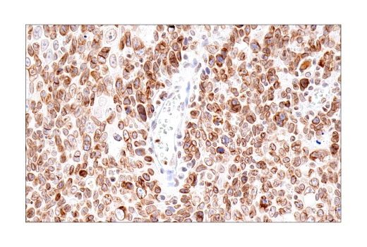 Immunohistochemistry Image 4: Lamin B1 (E6M5T) Rabbit mAb