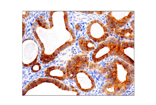 Immunohistochemistry Image 3: Bcl-2 (124) Mouse mAb (BSA and Azide Free)