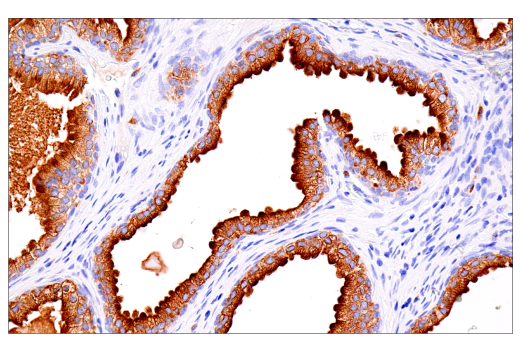 Rab27B (E4V3O) Rabbit MAb | Cell Signaling Technology