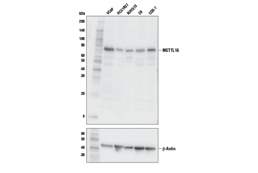 METTL16 Antibody | Cell Signaling Technology