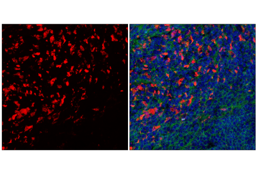 Immunofluorescence Image 2: CD68 (E3O7V) Rabbit mAb (Alexa Fluor® 647 Conjugate)