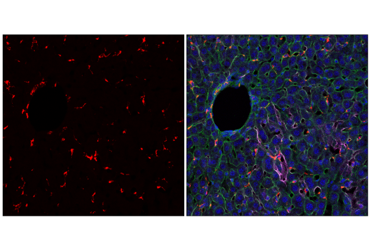 Immunofluorescence Image 1: CD68 (E3O7V) Rabbit mAb (Alexa Fluor® 647 Conjugate)