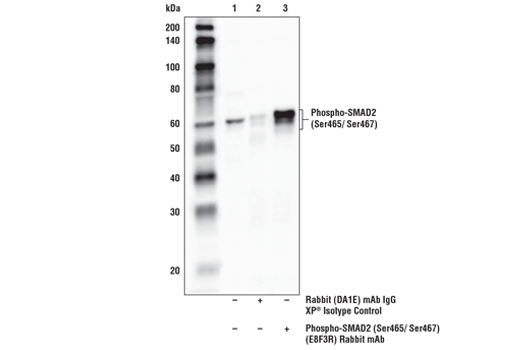  Image 11: TGF-β Fibrosis Pathway Antibody Sampler Kit
