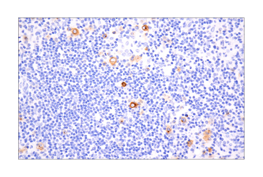 Immunohistochemistry Image 5: TNFRSF8/CD30 (E7E4D) XP® Rabbit mAb (BSA and Azide Free)