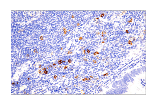 Immunohistochemistry Image 3: TNFRSF8/CD30 (E7E4D) XP® Rabbit mAb (BSA and Azide Free)