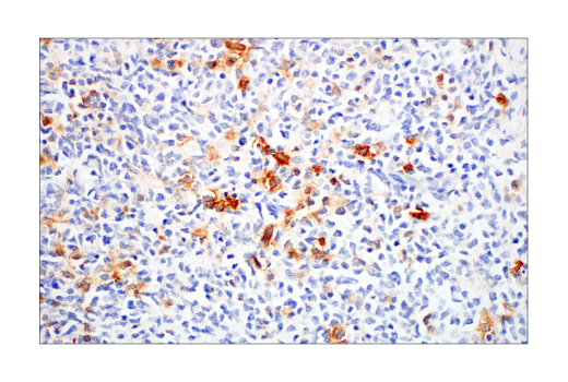 Immunohistochemistry Image 4: TNFRSF8/CD30 (E7E4D) XP® Rabbit mAb (BSA and Azide Free)