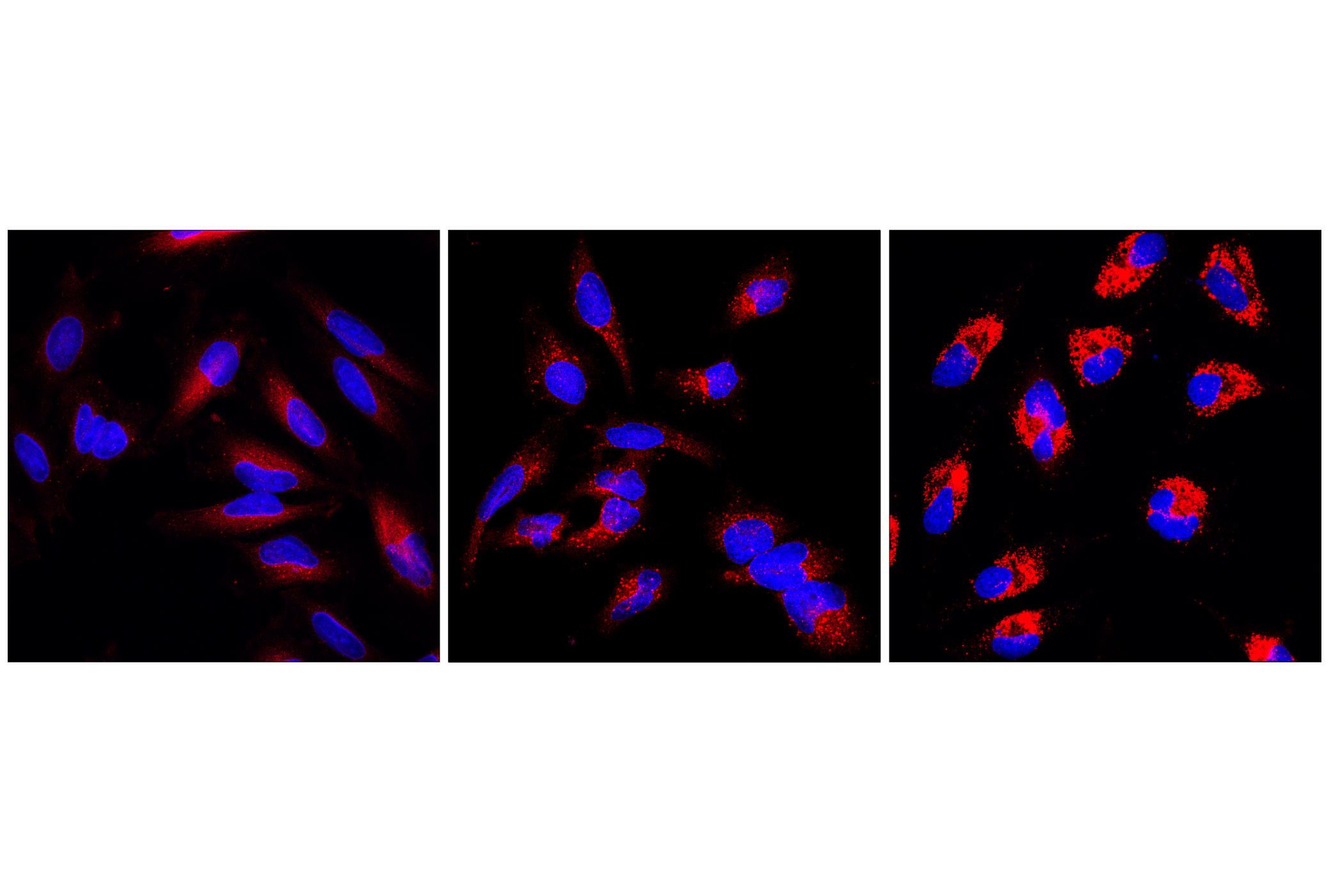 Immunofluorescence Image 1: LC3B (E5Q2K) Mouse mAb (Alexa Fluor® 647 Conjugate)