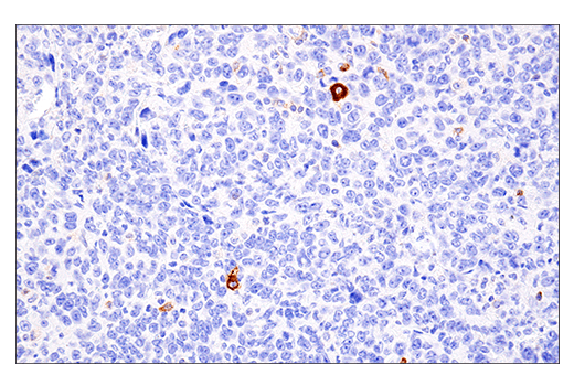 Immunohistochemistry Image 3: 4-1BB/CD137/TNFRSF9 (E2J5H) XP® Rabbit mAb