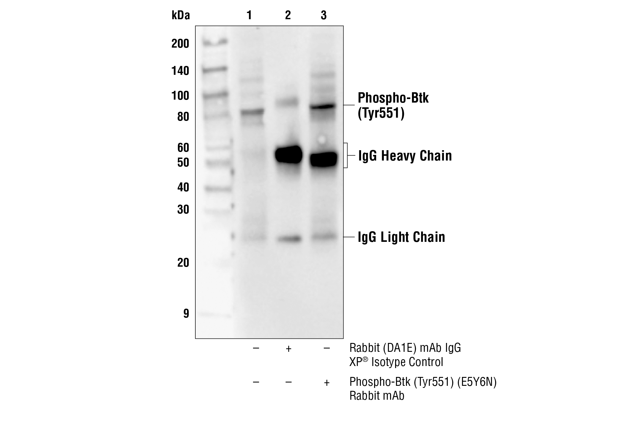 Immunoprecipitation Image 1: Phospho-Btk (Tyr551) (E5Y6N) Rabbit mAb