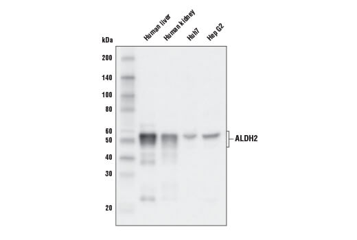 Western Blotting Image 1: ALDH2 Antibody