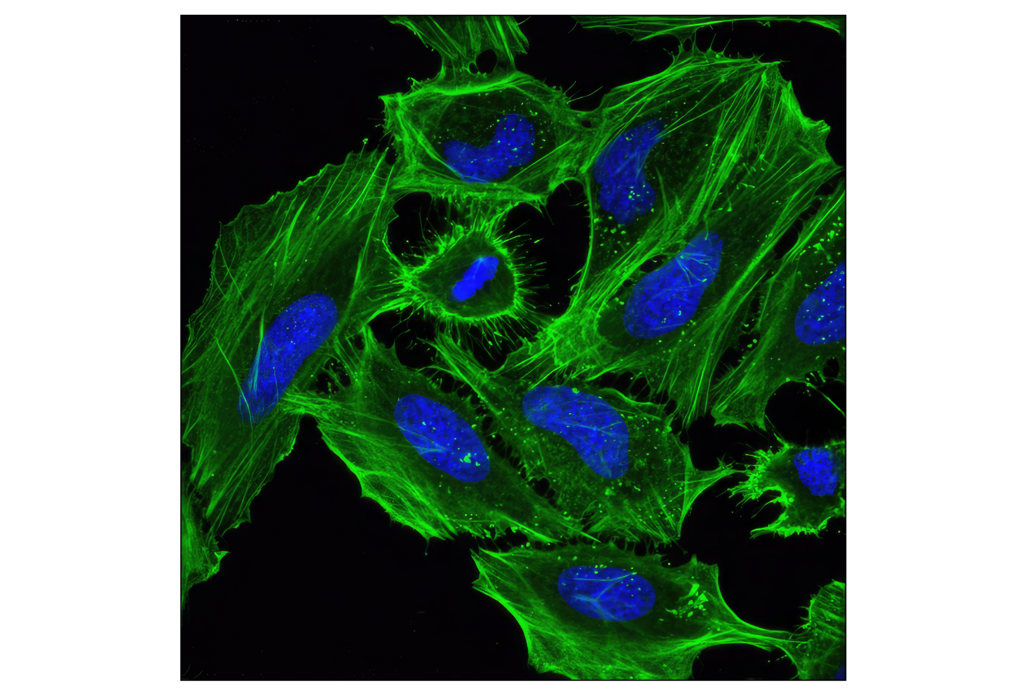 Immunofluorescence Image 1: β-Actin (D6A8) Rabbit mAb (BSA and Azide Free)