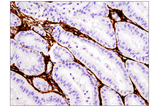  Image 20: TGF-β Fibrosis Pathway Antibody Sampler Kit