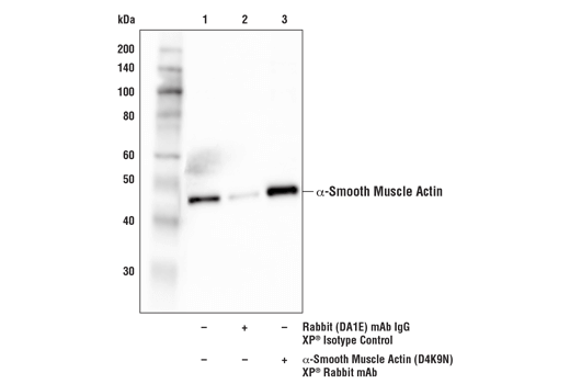  Image 12: TGF-β Fibrosis Pathway Antibody Sampler Kit